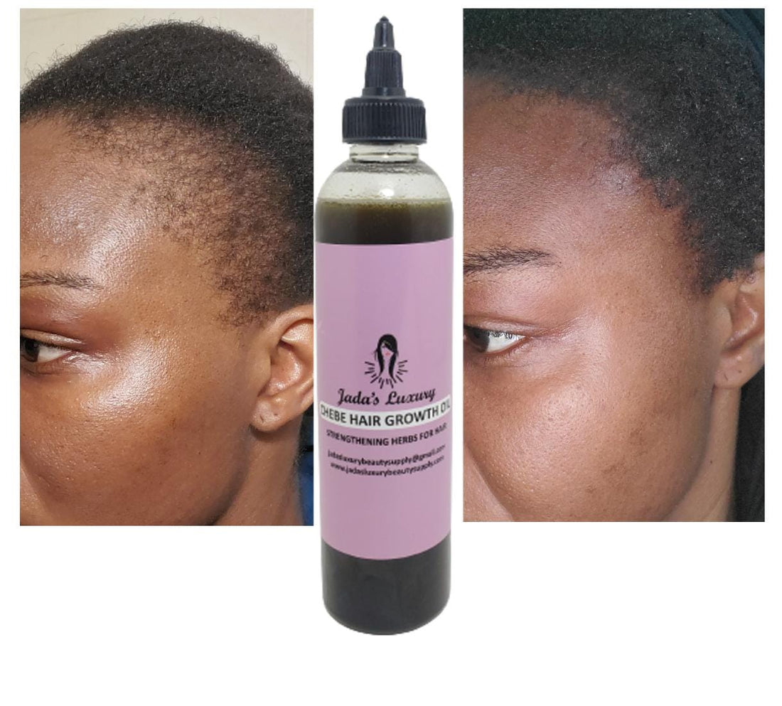 thinning hair women